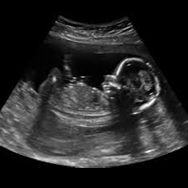 4d baby ultrasound price