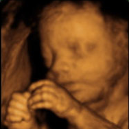 At Mommy and Me you will experience the best 3D 4D ultrasound. Call now.