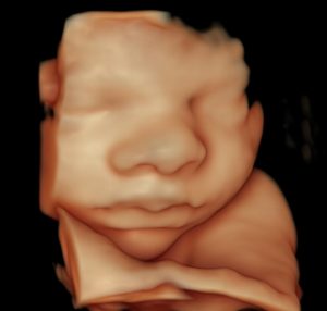 a baby visit 3d 4d ultrasound san diego photos