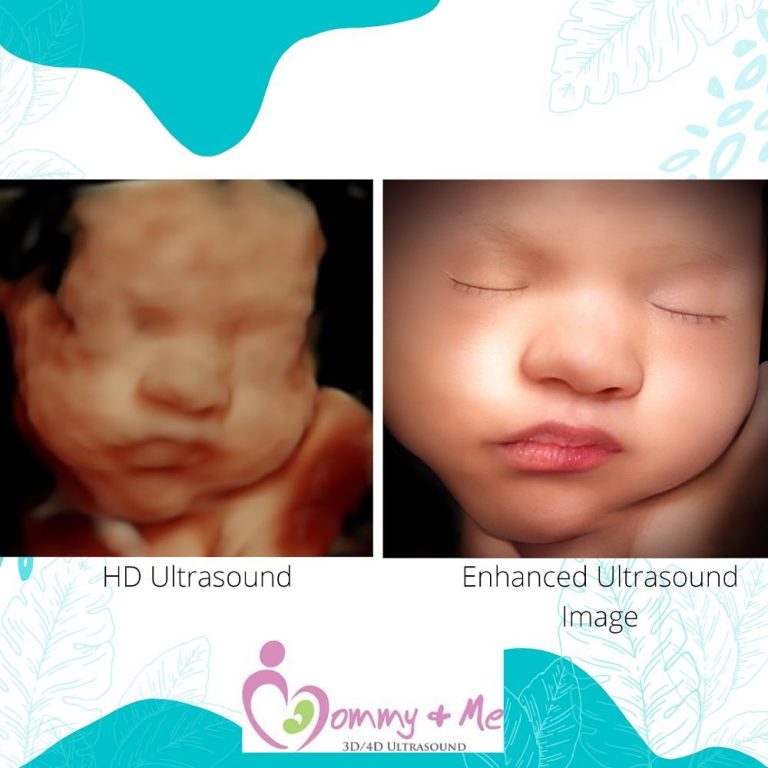 EXPERIENCE THE MAGIC OF 8K ENHANCED IMAGE ULTRASOUND WITH MOMMY AND ME